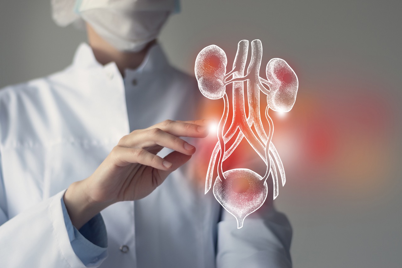 Kidney Stone Treatment in Gurugram